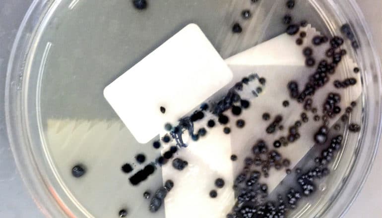 A petri dish with C. difficile in it (which show up as black spots)