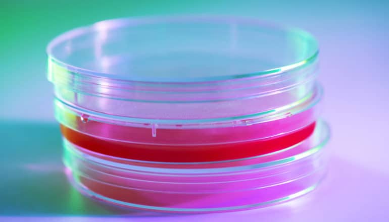 petri dishes with pink agar