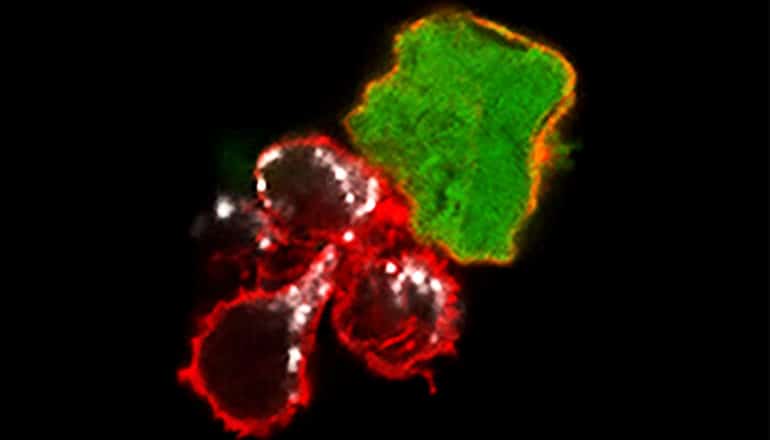 3 red blobs next to the green tumor tumor cell, which has an orange outline