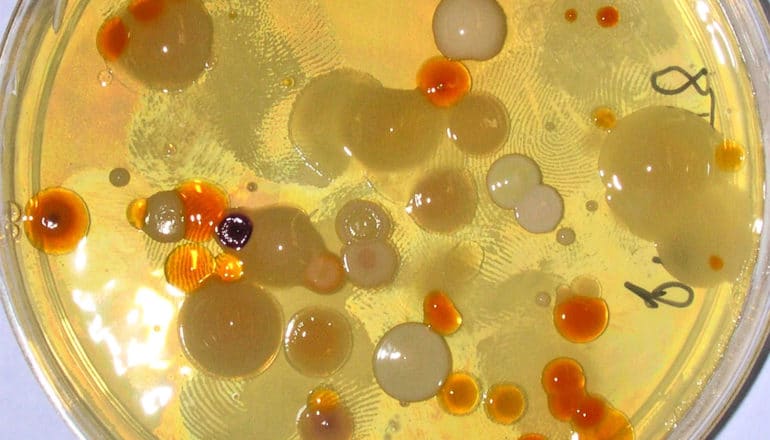 Bacteria grow in a petri dish in orange and yellow blobs