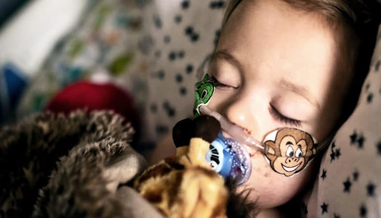 A toddler with a oxygen tube going into his nose and animal stickers keeping it in place sleeps while recovering from RSV in the hospital