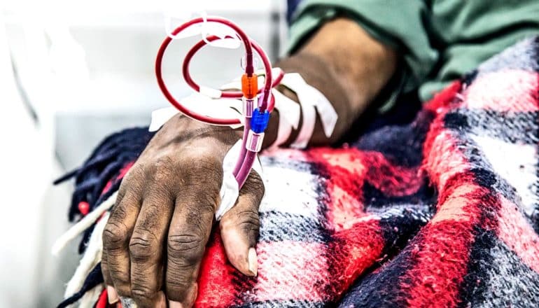 A man receives dialysis while sitting under a plaid blanket