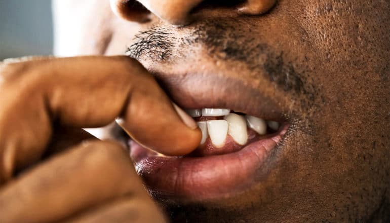 A man bites his fingernail in close up