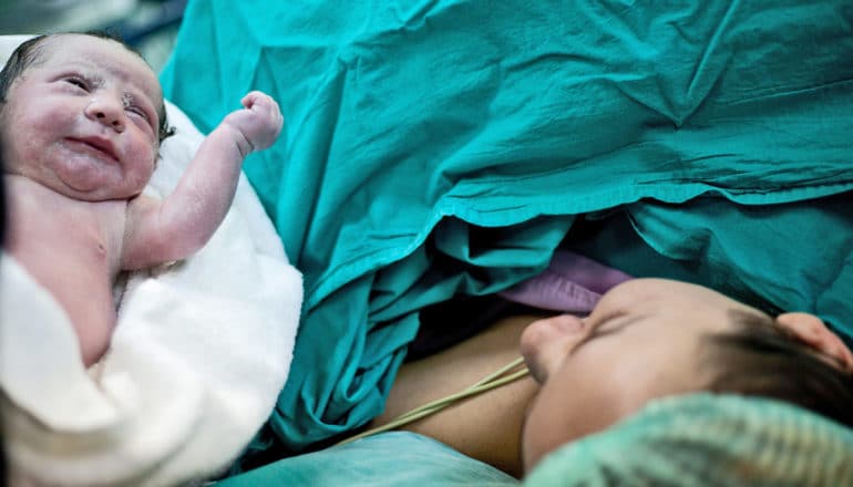 presentation of newborn after c-section