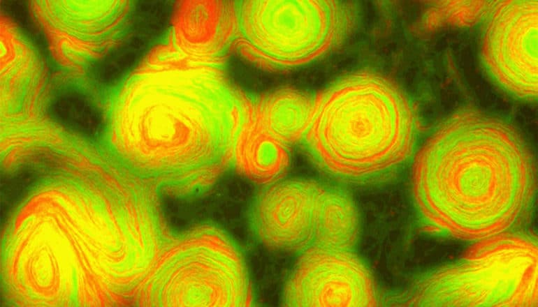 Swirls of bacteria appear green, yellow, and orange