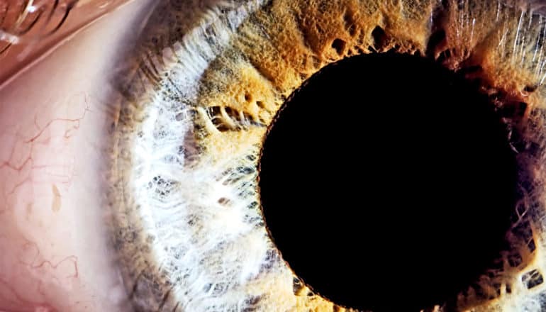 A close-up shot of an eyeball shows the black pupil