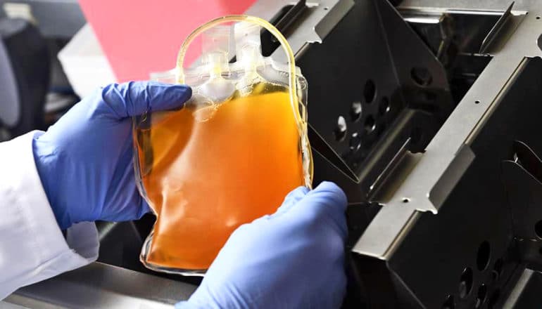 A physician removes a bag of donated COVID-19 convalescent plasma after thawing