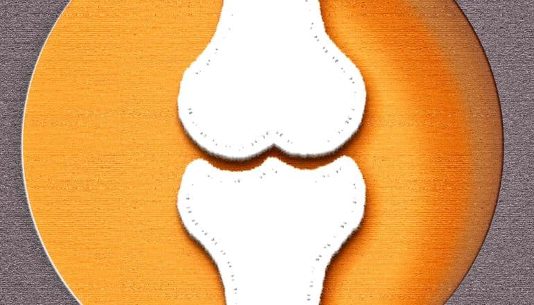 A felt representation of a knee bone on an orange background