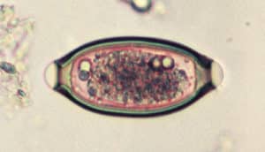 whipworm egg: oval capsule with tiny circles inside