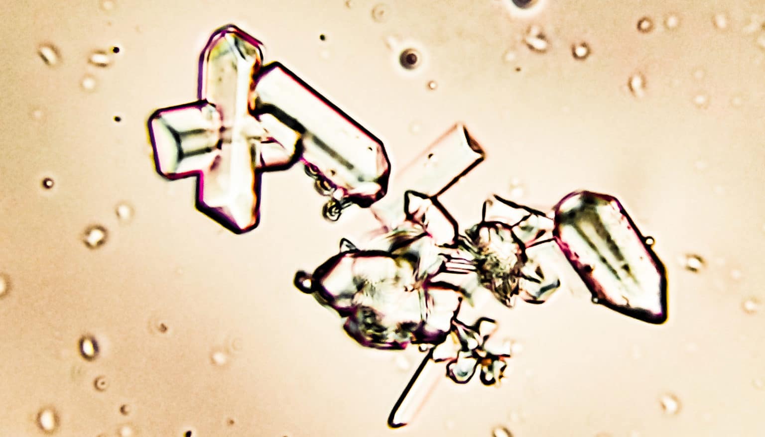 Struvite crystals in pet Urine under a microscope - Futurity