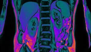 jewel-tones highlight tissues in midsection MRI