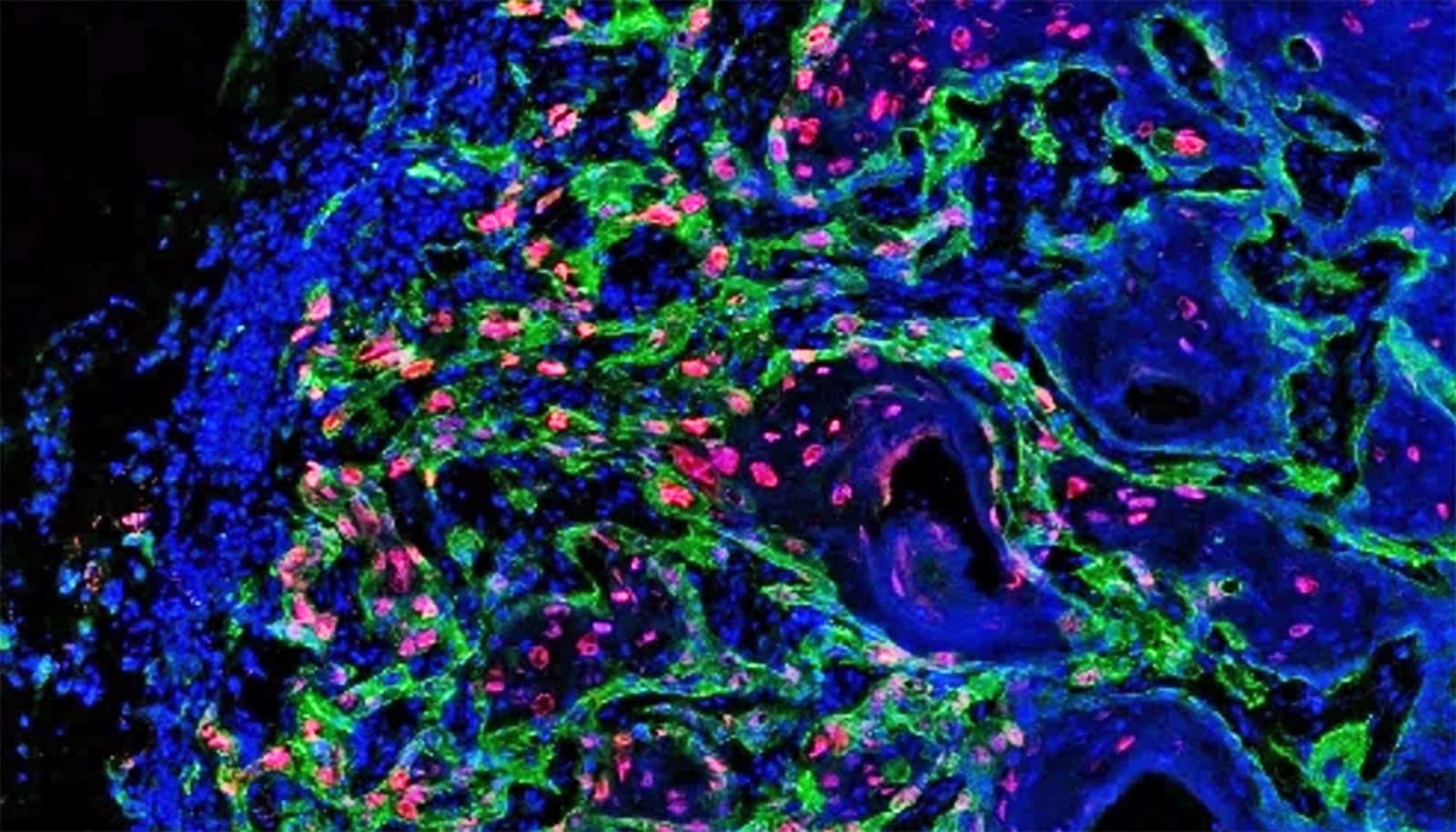 'Dialogue' with environment fuels cancer stem cells - TrendRadars