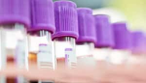 A row of purple-capped blood test vials.