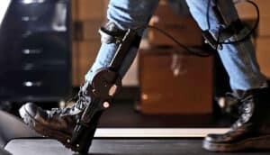 ankle prosthetics on lower legs in jeans and black boots