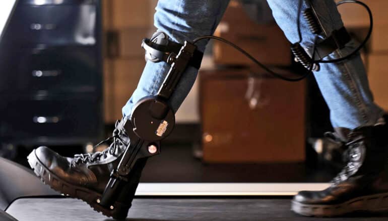 ankle prosthetics on lower legs in jeans and black boots