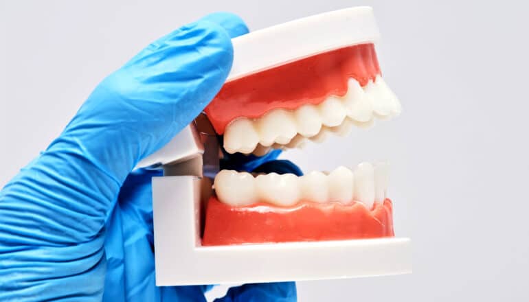 A person wearing a blue glove holds a model of human teeth and gums.