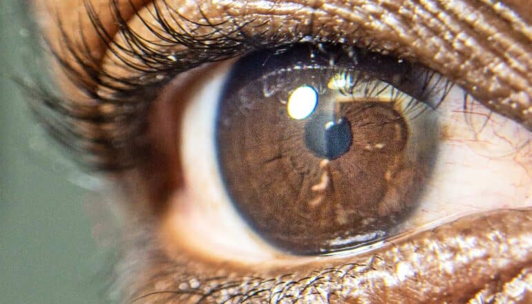 A close-up photo of an older man's eye.