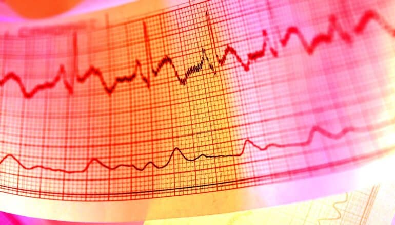 echocardiogram in red and orange light