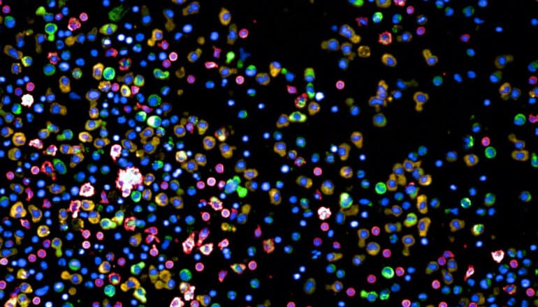 Cells of different colors on a black background.