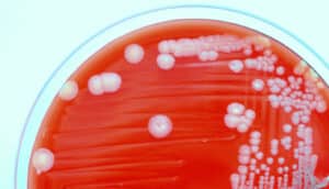 petri dish with red medium and white bacteria spots