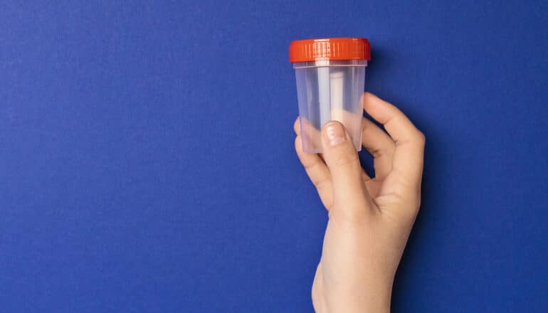 A person holds a urine sample cup with a red lid against a blue background.