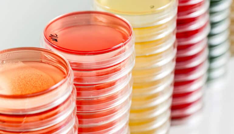 stacks of colorful petri dishes