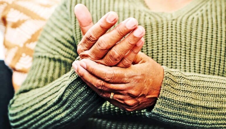 A woman holds one hand with the other in pain.