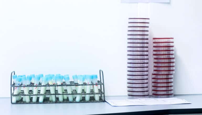 petri dishes and test tubes on counter