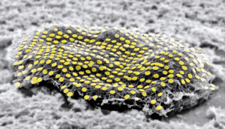 A cell has a nanodot array covering it, highlighted in yellow in this black and white image.