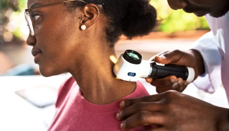 A doctor screens a woman for melanoma using a magnifying tool.