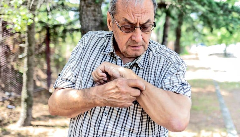 A man looks down at his arm and scratches it with his other hand.