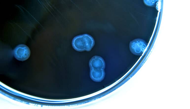 bacteria grow on blue growth medium in petri dish