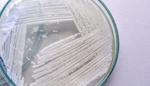 yeast grows in petri dish