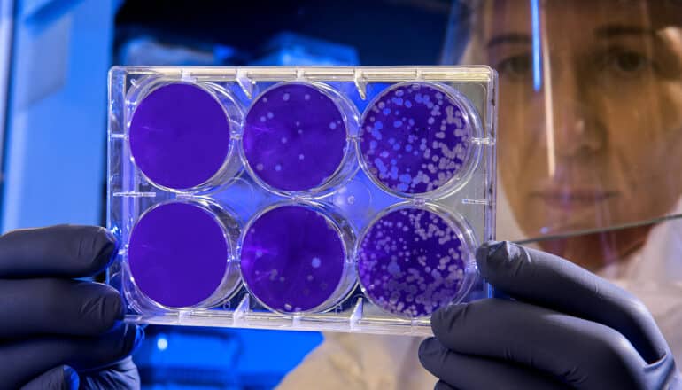 scientist holds up plaque assay