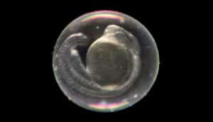 A zebrafish embryo against a black background.