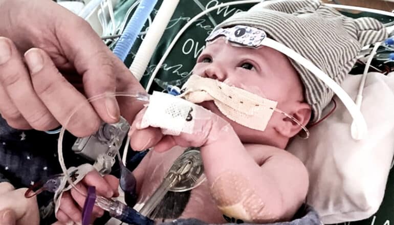 A baby in a hospital bassinet with wires and sensors on his skin.