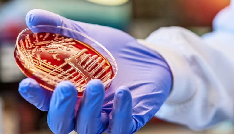 A researcher holds a petri dish filled with red bacteria.