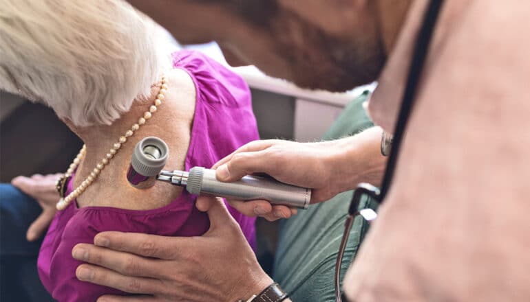 A doctor checks a mole on an older woman's skin.