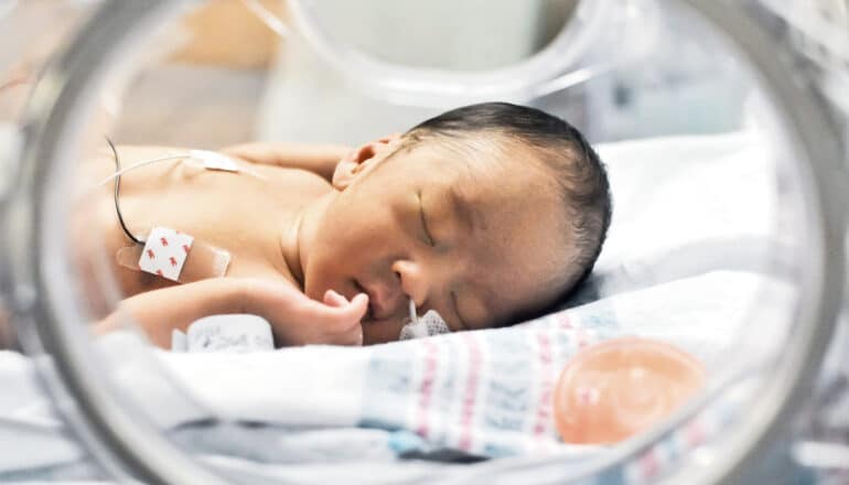 A baby in a NICU bassinet.