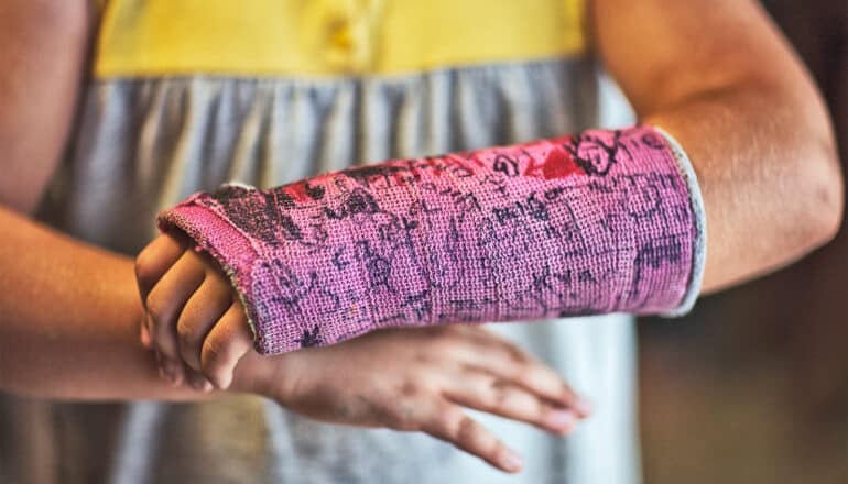 A child wears a purple cast covered in signatures and writing.