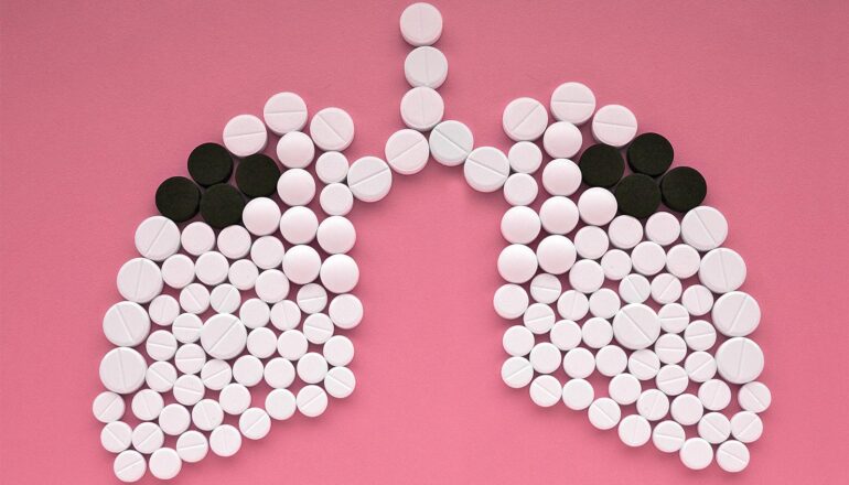 White pills arranged on a pink surface to look like lungs with a few black pills to symbolize cancer.