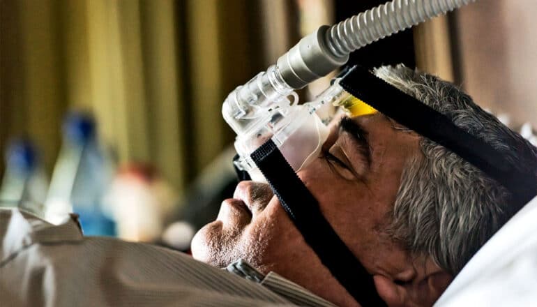 A man sleeps with a sleep apnea mask over his nose.