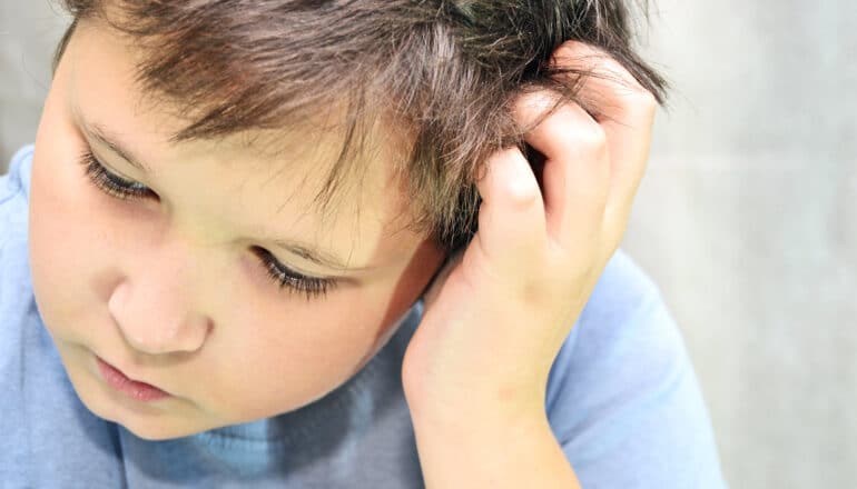 A young boy touches his head with his left hand while looking down.