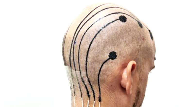 A bald man has wires running up the back of his neck connected to black e-tattoos that expand over his head.