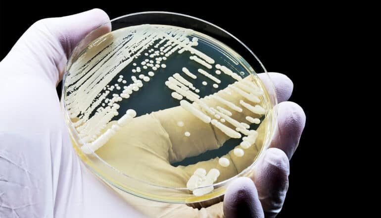 A scientist wearing a white glove holds a petri dish contain a sample of the fungus candida auris.