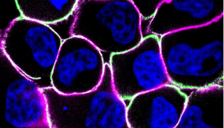 Breast cancer cells highlighted in different colors sit side-by-side on a black background.