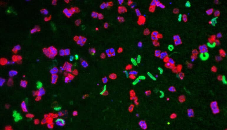 Several bacteria species highlighted in different colors on a dark background.