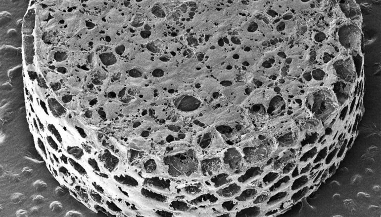 A microscopic view of the tiny sponge-like implant shows many nooks and crannies.