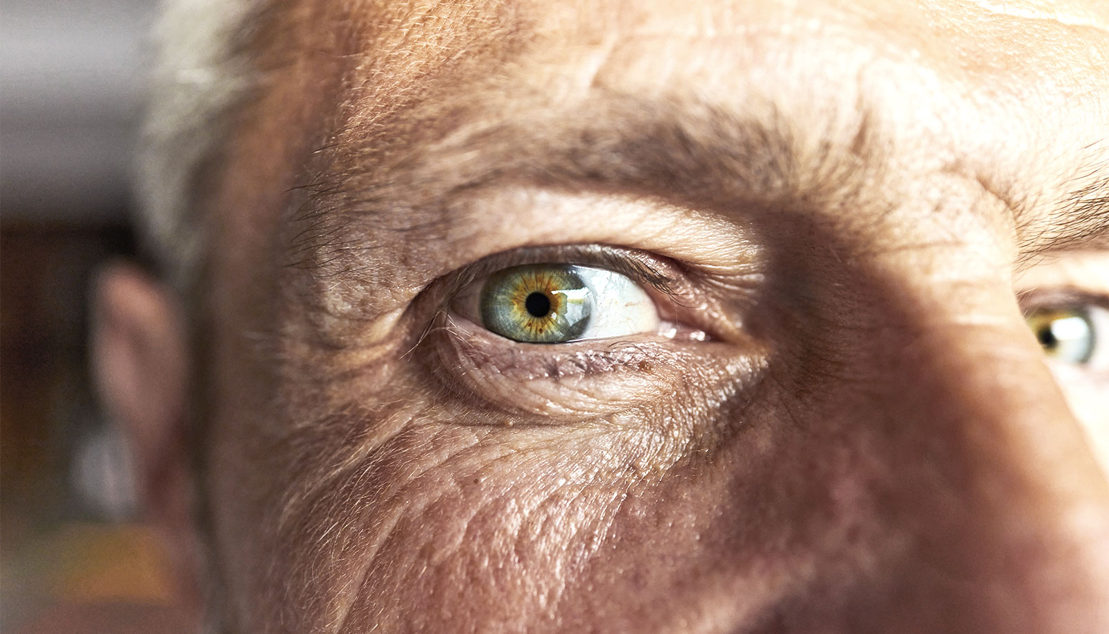 Eye changes may be early warning for Alzheimer’s